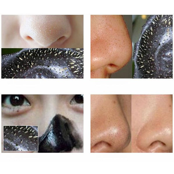 Black Head Remover (Free Shipping)